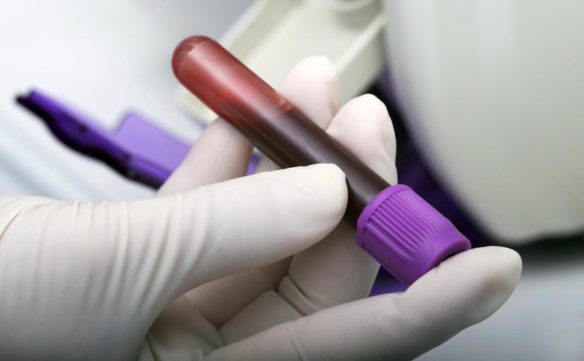 Por que fazer testes de sangue para diagnosticar alergia?