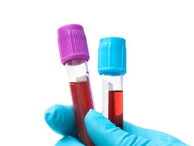 Quando o exame de sangue é indicado para investigar alergia?